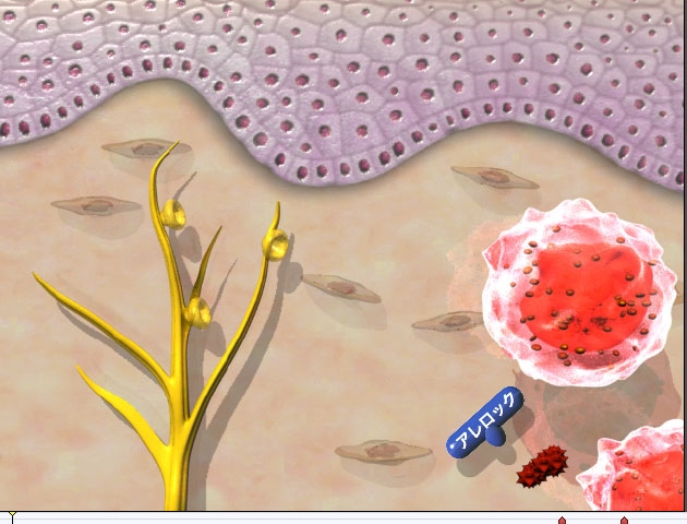 allelock-histamin-screenshot